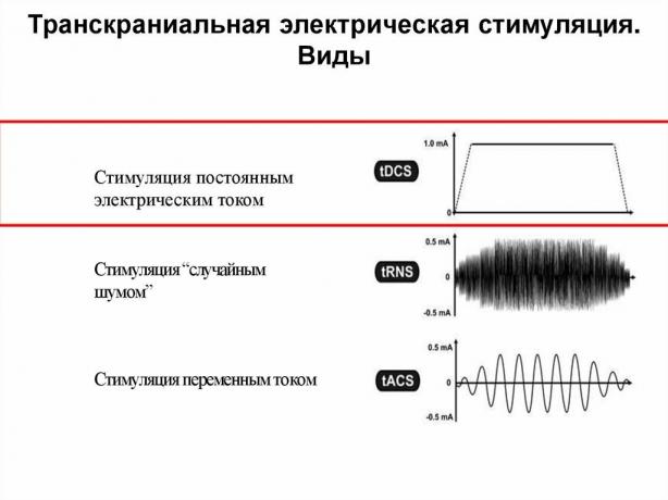 Lehetséges, hogy javítja a memóriát elektromossággal?