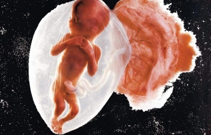 Első fotó baba embrió.